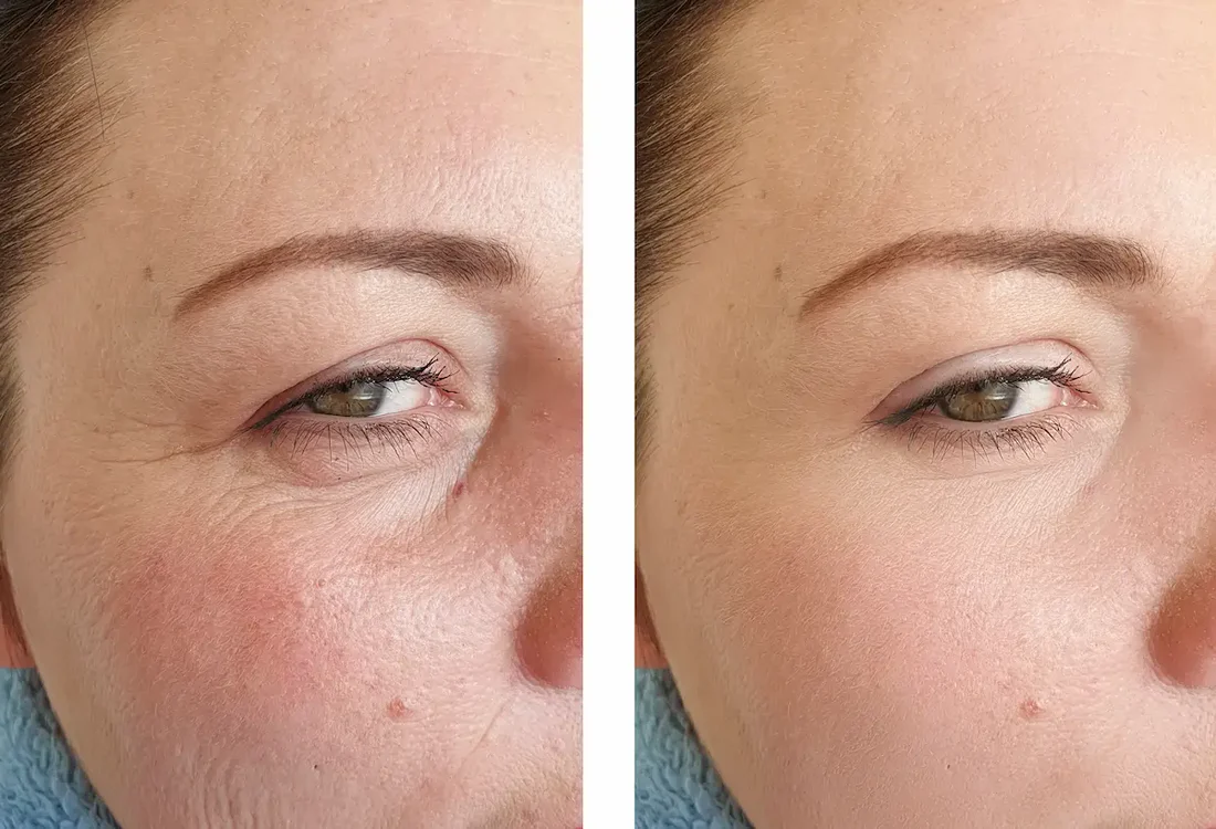 Retinol Skincare Guide: Unlock Your Best Skin at Any Age