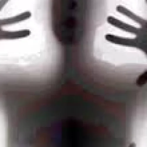 Schizophrenia Mental Illness: Causes, Symptoms & Treatment