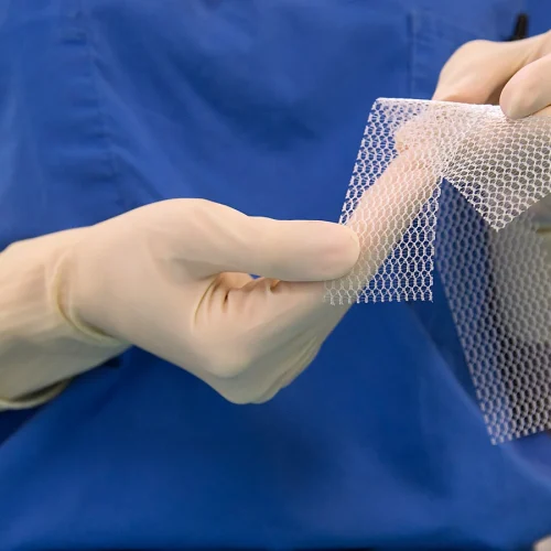 Pelvic Mesh Reforms Ignored by Government