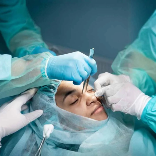 Endoscopic Sinus Surgery: Procedure, Benefits & Recovery