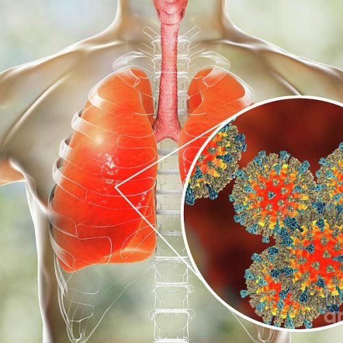 Measles Affects the Immune System and Erases Its Memory