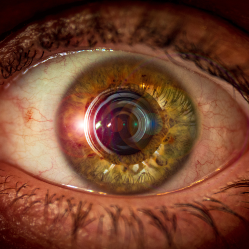 Parts of the Eye: How Eye Anatomy Helps Us See Clearly