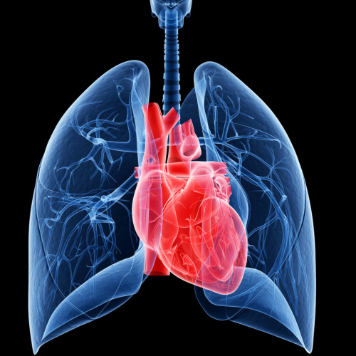 Pulmonary Hypertension: Symptoms, Risks & Treatment