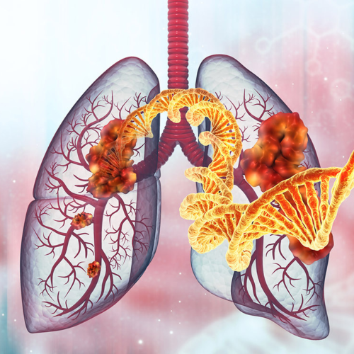Lung Cancer Treatment Disparities: Race & SES Effects