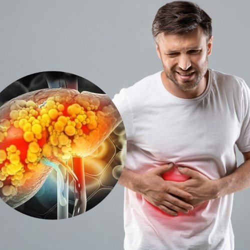 Sugary Beverages and Fatty Liver: Risks and Prevention