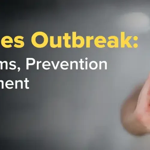Measles Outbreak in the US: Causes, Symptoms, and Prevention