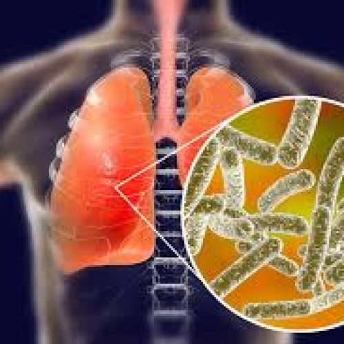 Legionnaires’ Disease: Symptoms, Treatment, and Prevention